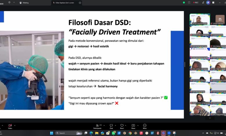 Tangkapan layar presentasi materi Filosofi Dasar DSD Facially Driven Treatment pada kuliah umum daring FKG UMS